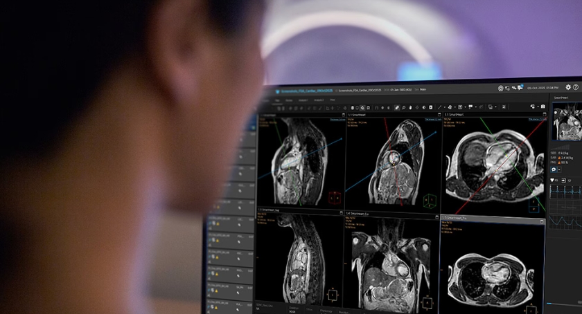 Philips Wins FDA Nod for SmartHeart AI Cardiac MR Planning Tool